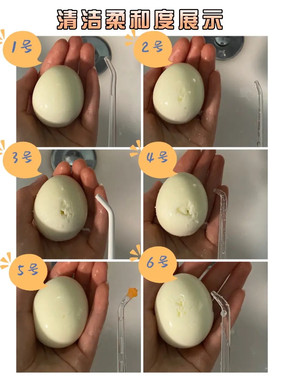 根管治疗后才知道冲牙器要早点买！图片_6
